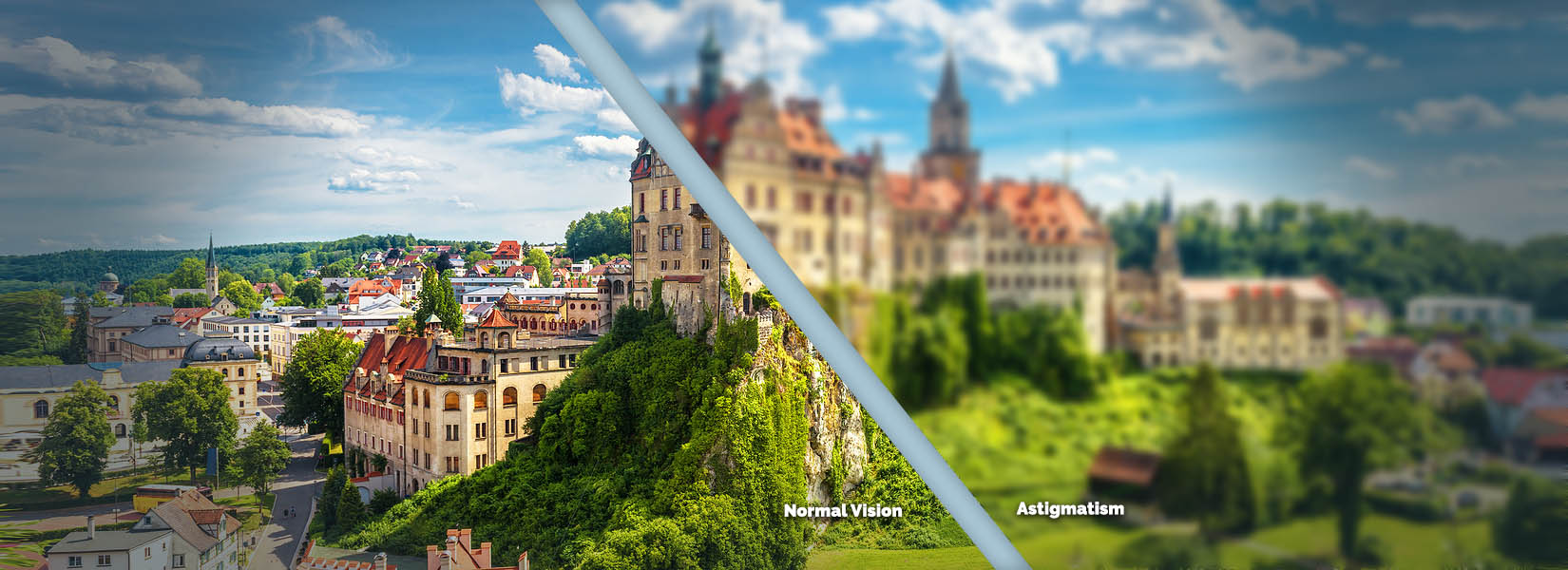 Astigmatism Treatment in Highland
