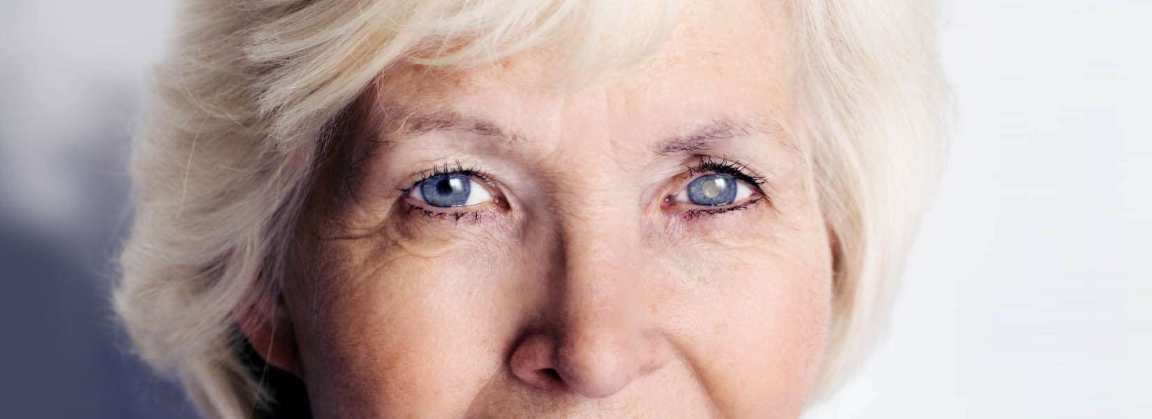 Cataract Surgery in Highland
